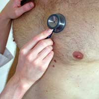Male Breast Reduction Liposuction