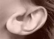 Why I Had My Ears Pinned: A Case Study