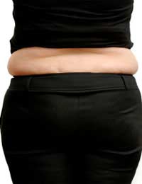 Smartlipo Fat Liposuction Downtime