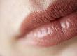 What is Lip Reduction?