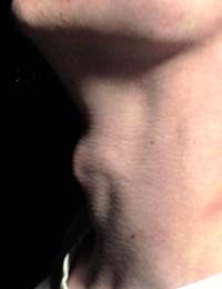 Adam’s Apple Trachea Shave Throat Men